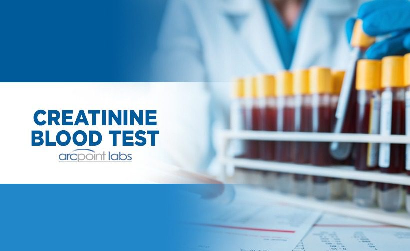 Creatinine Blood Test - ARCpoint Lab North Tampa FL