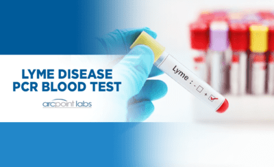 lyme disease pcr diseases panels test blood