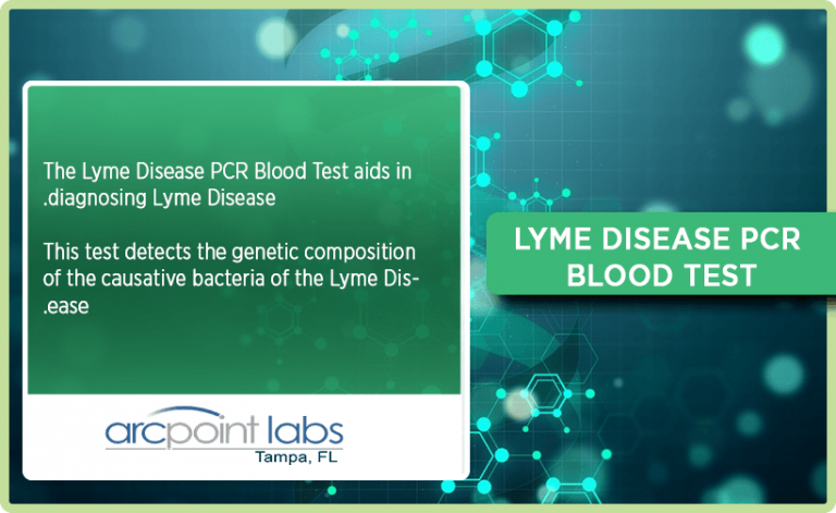 Lyme Disease PCR Blood Test - ARCpoint Lab Tampa FL